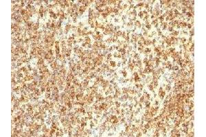 IHC testing of CD20 antibody and human lymphoma tissue