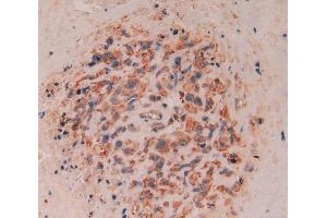 Used in DAB staining on fromalin fixed paraffin- embedded lung cancer tissue (CD8B anticorps  (AA 22-170))