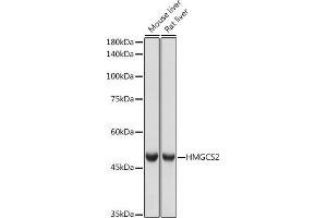 Western blot analysis of extracts of various cell lines, using HMGCS2 antibody (ABIN7265328) at 1:1000 dilution. (HMGCS2 anticorps)