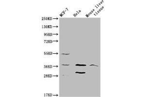 Western blot All lanes: MRGPRX2 antibody at 5 μg/mL Lane 1: 293T whole cell lysate Lane 2: Mouse liver tissue Secondary Goat polyclonal to rabbit IgG at 1/10000 dilution Predicted band size: 38 kDa Observed band size: 38 kDa