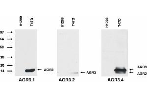 Western blotting analysis of AGR3 protein by and AGR3. (AGR3 anticorps)