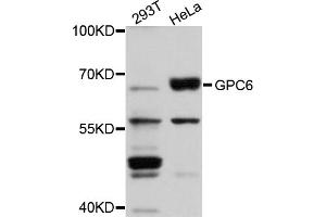 Western blot analysis of extracts of various cell lines, using GPC6 antibody (ABIN5974717) at 1/1000 dilution. (Glypican 6 anticorps)