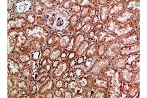 Immunohistochemical analysis of paraffin-embedded human-kidney, antibody was diluted at 1:200 (c-Rel anticorps  (AA 491-540))