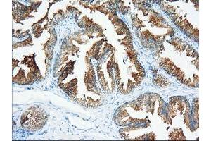 Immunohistochemical staining of paraffin-embedded Human prostate tissue using anti-XPNPEP1 mouse monoclonal antibody. (XPNPEP1 anticorps)