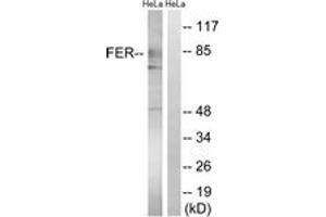 Image no. 1 for anti-FER Tyrosine Kinase (FER) (AA 371-420) antibody (ABIN2889104) (FER anticorps  (AA 371-420))