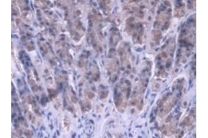 DAB staining on IHC-P; Samples: Rat Stomach Tissue (MRPL1 anticorps  (AA 141-323))