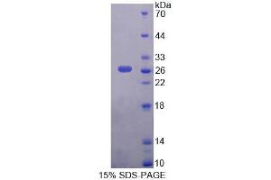 SDS-PAGE analysis of Human AADAT Protein.