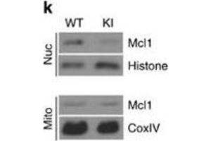 Inactivation of GSK3β by p38 MAPK promotes accumulation of the prosurvival factor Mcl-1.