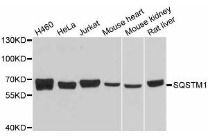 Western blot analysis of extracts of various cell lines, using SQSTM1 antibody. (SQSTM1 anticorps  (AA 1-440))
