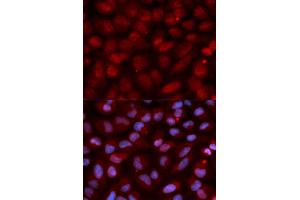 Immunofluorescence analysis of U2OS cell using CD47 antibody. (CD47 anticorps)