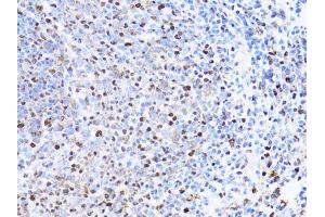 Immunohistochemistry of paraffin-embedded rat spleen using PCNA antibody (ABIN1874056) at dilution of 1:100 (40x lens).