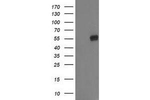 Western Blotting (WB) image for anti-Glucosidase, Beta, Acid 3 (Cytosolic) (GBA3) (AA 1-150), (AA 370-469) antibody (ABIN1490586)