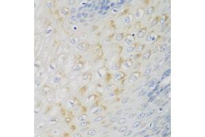 Immunohistochemistry of paraffin-embedded human esophagus using NME4 antibody at dilution of 1:100 (40x lens). (NME4 anticorps)