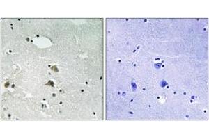Immunohistochemistry analysis of paraffin-embedded human brain tissue, using S6 Ribosomal Protein (Ab-235/236) Antibody. (RPS6 anticorps  (AA 200-249))