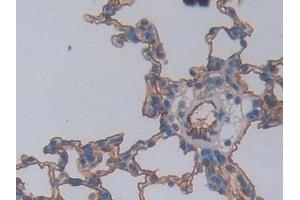 Detection of ICAM1 in Rat Lung Tissue using Polyclonal Antibody to Intercellular Adhesion Molecule 1 (ICAM1)
