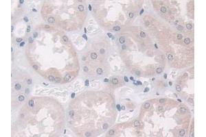 Detection of PAI1 in Human Kidney Tissue using Monoclonal Antibody to Plasminogen Activator Inhibitor 1 (PAI1)