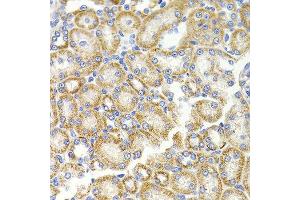 Immunohistochemistry of paraffin-embedded rat kidney using BMP15 antibody at dilution of 1:100 (x40 lens). (BMP15 anticorps)