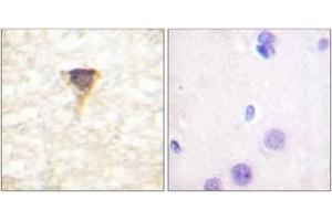 Immunohistochemistry analysis of paraffin-embedded human brain tissue, using CaMK4 (Ab-196/200) Antibody. (CAMK4 anticorps  (AA 166-215))
