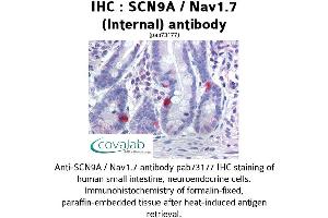 Image no. 1 for anti-Sodium Channel, Voltage-Gated, Type IX, alpha Subunit (SCN9A) (AA 460-510), (Internal Region) antibody (ABIN1739064) (SCN9A anticorps  (Internal Region))