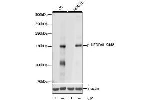 Western blot analysis of extracts of various cell lines, using Phospho-NEDD4L-S448 antibody (ABIN7266883) at 1:1000 dilution.