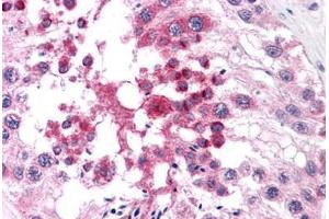 Human Testis: Formalin-Fixed, Paraffin-Embedded (FFPE)