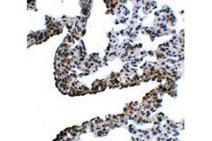 Immunohistochemistry of PCDH12 in rat lung tissue with PCDH12 polyclonal antibody  at 5 ug/mL . (PCDH12 anticorps  (N-Term))