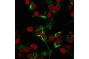 Immunofluorescence Analysis of PFA-fixed HepG2 cells labeling AFP using AFP Mouse Monoclonal Antibody (C2 + C3 + MBS-12) followed by Goat anti-Mouse IgG-CF488 (Green). (alpha Fetoprotein anticorps)