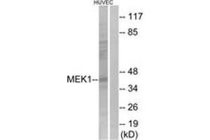 Western blot analysis of extracts from HuvEc cells, using MEK1 (Ab-298) Antibody. (MEK1 anticorps  (AA 264-313))