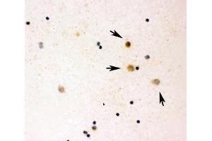 ICC testing of IL16 antibody and human cord blood (IL16 anticorps  (AA 1212-1332))