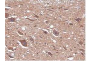 Figure. (CAMK2A anticorps  (AA 1-478))