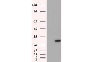 Western Blotting (WB) image for anti-Nitrilase Family, Member 2 (NIT2) antibody (ABIN1499740) (NIT2 anticorps)