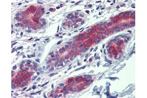 Anti-YES1 antibody IHC of human breast. (YES1 anticorps  (AA 284-541))