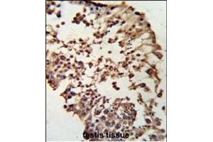 Formalin-fixed and paraffin-embedded human testis tissue reacted with RB1 Antibody (C-term), which was peroxidase-conjugated to the secondary antibody, followed by DAB staining.