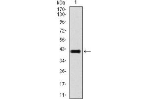 Western blot analysis using TGFb1 antibody against human TGFb1 recombinant protein. (TGFB1 anticorps  (AA 62-195))