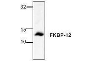 Image no. 1 for anti-FK506 Binding Protein 1A, 12kDa (FKBP1A) antibody (ABIN127265) (FKBP1A anticorps)