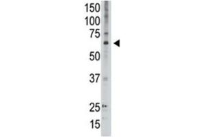 Western Blotting (WB) image for anti-Melanoma Antigen Family D, 2 (MAGED2) antibody (ABIN3002534) (MAGED2 anticorps)