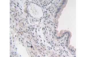 IHC-P analysis of Mouse Uterus Tissue, with DAB staining. (SYN1 anticorps  (AA 113-420))
