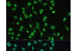 Immunofluorescence analysis of C6 cells using PXR Polyclonal Antibody at dilution of 1:100 (40x lens). (NR1I2 anticorps)