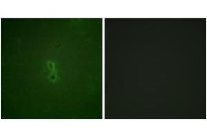 Immunofluorescence analysis of NIH-3T3 cells, using BCL-XL (Phospho-Thr47) Antibody. (BCL2L1 anticorps  (pThr47))