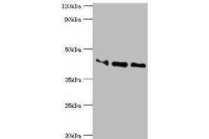 Western blot All lanes: Apolipoprotein L1 antibody at 10 μg/mL Lane 1: A549 whole cell lysate Lane 2: Hela whole cell lysate Lane 3: HepG2 whole cell lysate Secondary Goat polyclonal to rabbit IgG at 1/10000 dilution Predicted band size: 44, 46, 43 kDa Observed band size: 44 kDa (APOL1 anticorps  (AA 179-398))