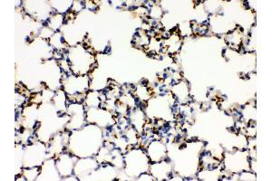 Anti- ITGA2B Picoband antibody, IHC(P) IHC(P): Mouse Lung Tissue