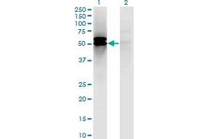 Western Blot analysis of DLST expression in transfected 293T cell line by DLST monoclonal antibody (M01), clone 4D7.