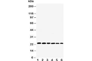 Western blot testing of SNAP23 antibody and Lane 1:  rat spleen;  2: (r) testis;  3: (r) ovary;  4: human HeLa;  5: (h) MCF-7;  6: (h) SKOV;  Expected size: ~23KD (SNAP23 anticorps  (C-Term))