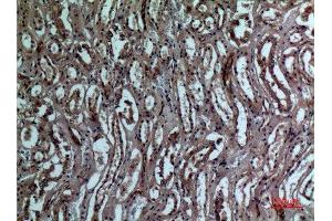 Immunohistochemistry (IHC) analysis of paraffin-embedded Human Kidney, antibody was diluted at 1:100. (BNIP3 anticorps  (Internal Region))