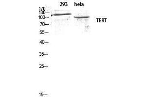 Western Blotting (WB) image for anti-Telomerase Reverse Transcriptase (TERT) (Tyr1510) antibody (ABIN3177676) (TERT anticorps  (Tyr1510))