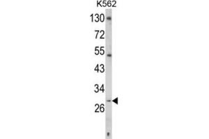 Western Blotting (WB) image for anti-CD40 Ligand (CD40LG) antibody (ABIN3002678) (CD40 Ligand anticorps)
