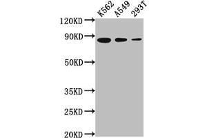 Western Blot Positive WB detected in: K562 whole cell lysate, A549 whole cell lysate, 293T whole cell lysate All lanes: XRCC5 antibody at 1:2000 Secondary Goat polyclonal to rabbit IgG at 1/50000 dilution Predicted band size: 83 kDa Observed band size: 83 kDa