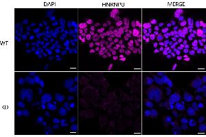 Immunocytochemical staining of HeLa cells using HNRNPUL1 antibody (ABIN7798903), 1:1,000), Top panel: wild-type (WT), Bottom panal: HNRNPUL1 shRNA knockdown (KD). (Recombinant HNRNPUL1 anticorps)