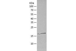 Calcineurin B (CAN) (AA 1-173) protein (His-IF2DI Tag)