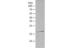 Western Blotting (WB) image for Calcineurin B (CAN) (AA 1-173) protein (His tag) (ABIN7122079)